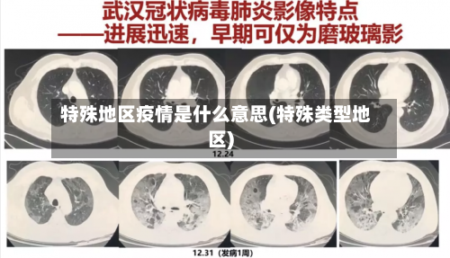 特殊地区疫情是什么意思(特殊类型地区)