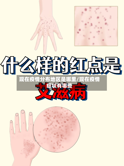 现在疫情分布地区是哪里/现在疫情症状有哪些